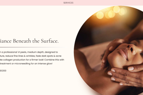 Chemical peel service page